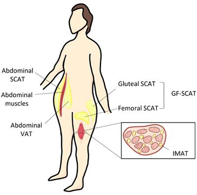 Mechanisms of body fat distribution and gluteal-femoral fat protection against metabolic disorders